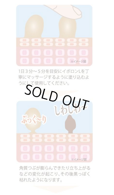 画像10: イポロンL (10)