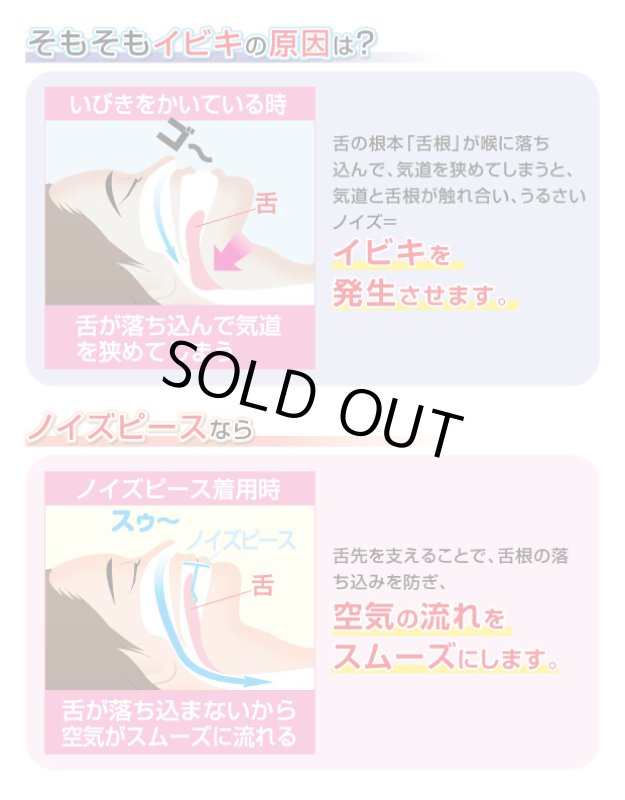 画像4: いびき対策マウスピース「ノイズピース」 (4)