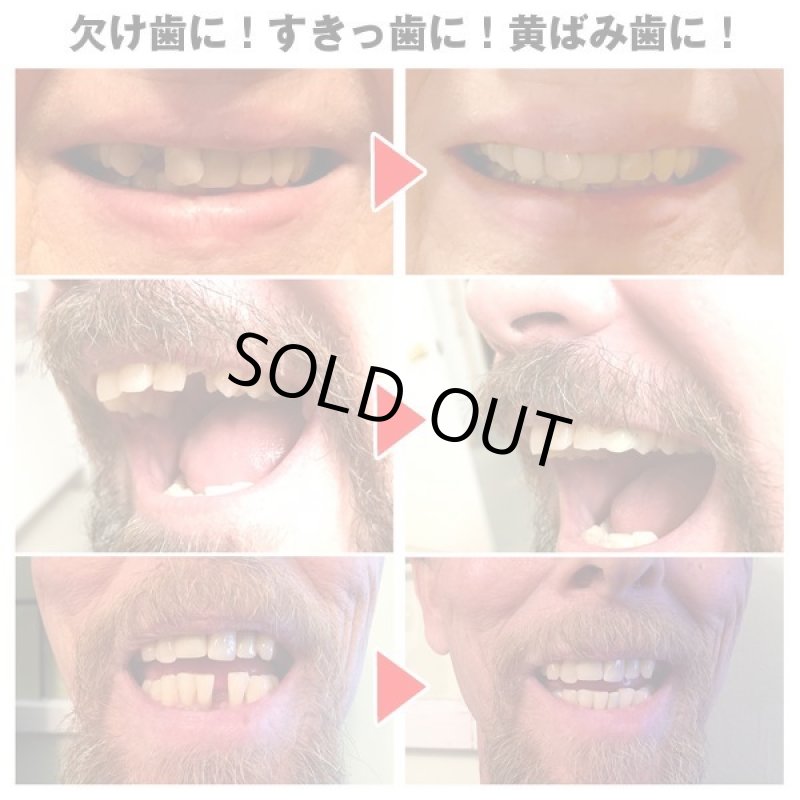 画像4: 本物・正規品インスタントスマイル「テンポラリーキットマルチセット」 (4)