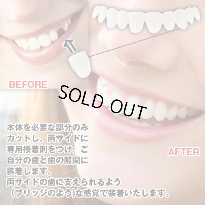 画像2: 本物・正規品インスタントスマイル「テンポラリーキットマルチセット」 (2)