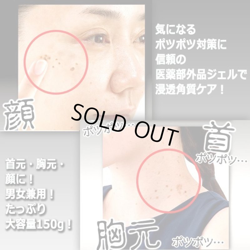 画像3: 肌のポツポツ＆ツブツブケア！はとむぎ・杏仁配合薬用イポツルン習慣150g[3点] (3)