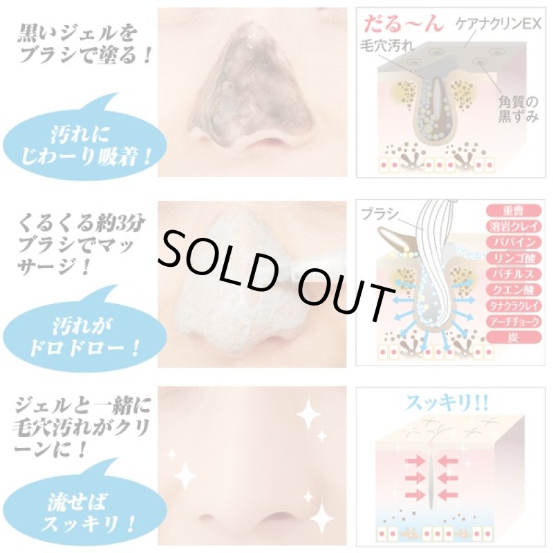 画像2: ケアナクリンEX (小鼻専用パック,小鼻黒ずみ対策,毛穴パック,洗い流し,男女兼用,黒ずみ,ぽつぽつ,イチゴ鼻,角栓対策) (2)