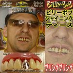 画像3: BillyBob(ビリーボブ)シャイニングティース（ハロウィン/リアル/付け歯/変装/変身/光る/ブリングブリング/ゴールド/プラチナ） (3)