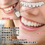 画像2: 本物・正規品インスタントスマイル「テンポラリーキット」 (2)