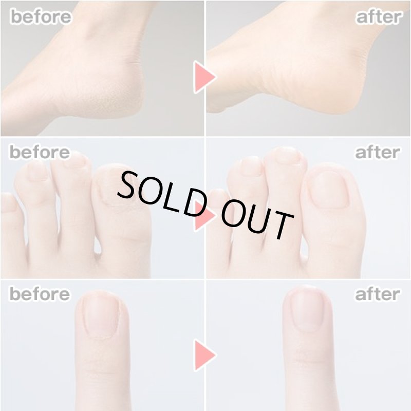 画像4: 送料無料マニクイックエイトフットケア (かかとスムーバー電動爪磨き,フットケア,ネイルケア,ひじ,ヒザ,電動ローラー,美容器具) (4)